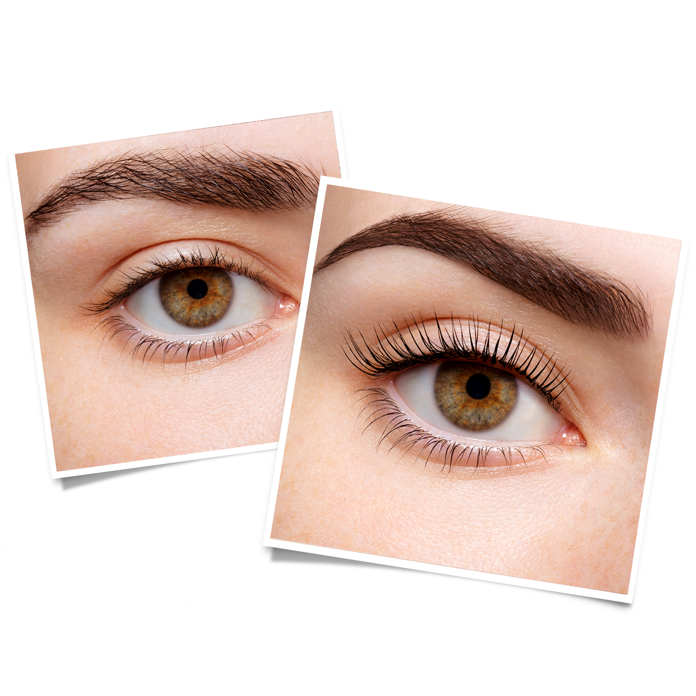 LVL Before and After Treatments LVL Before and After Treatments